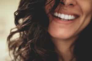 smile with white teeth